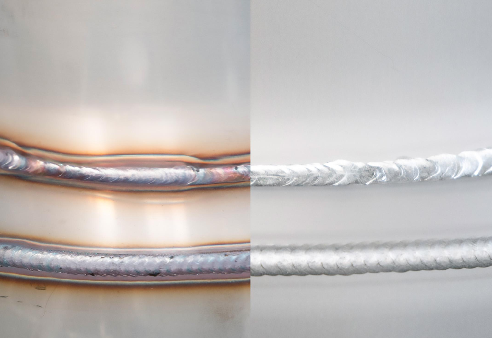 trước và sau khi tẩy trắng